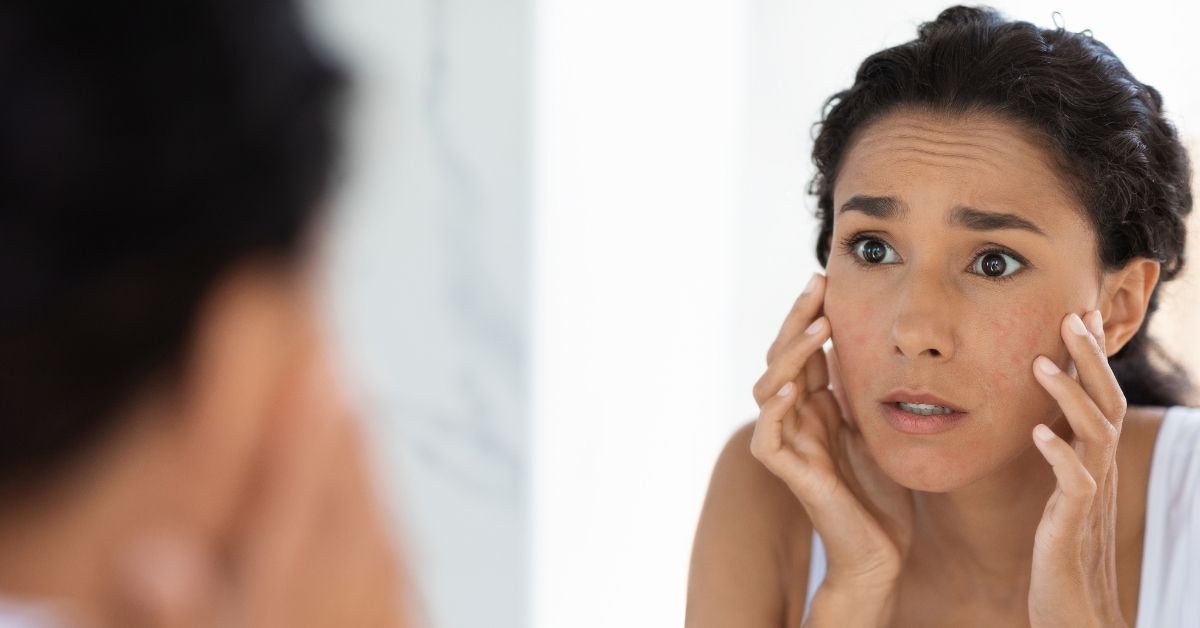 Natural and Safe Skincare Solutions for Sensitive Skin